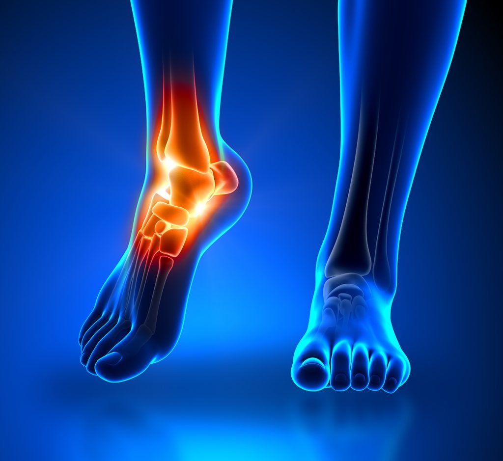 foot pain