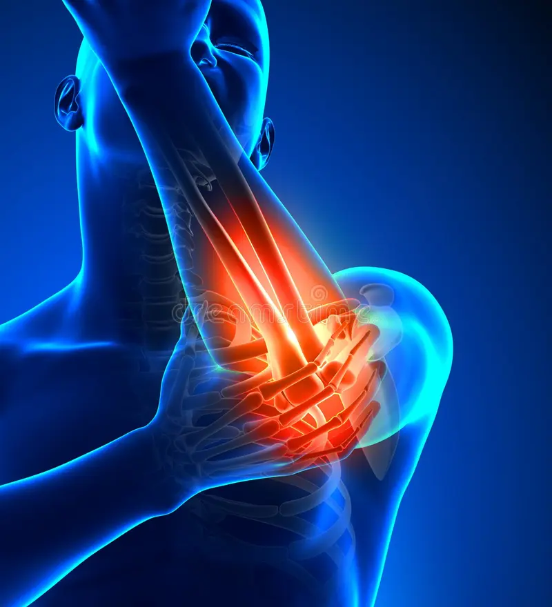 tennis golfer elbow pain