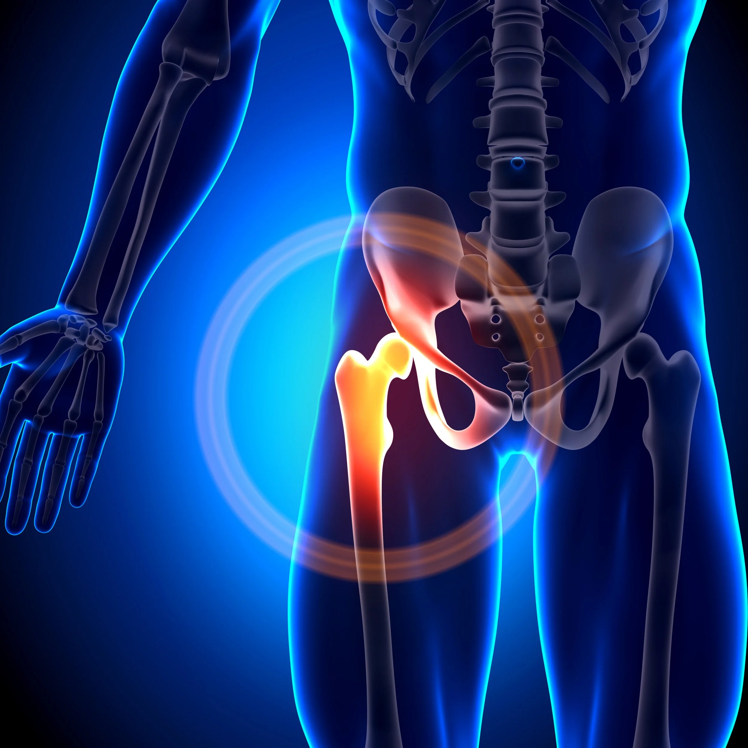 Hip pain illustration