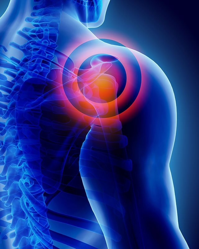 shoulder pain